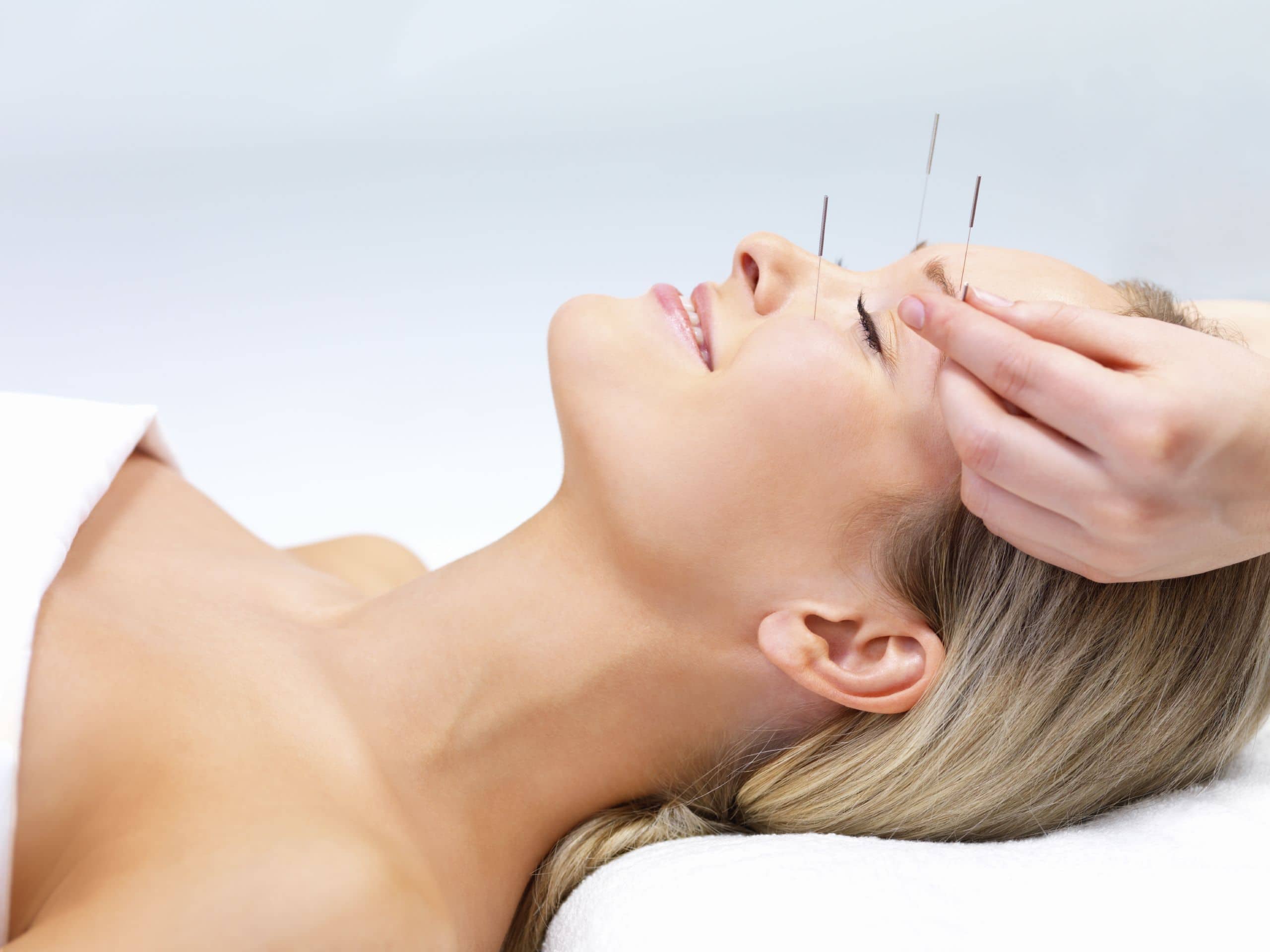 Medizinische Akupunktur