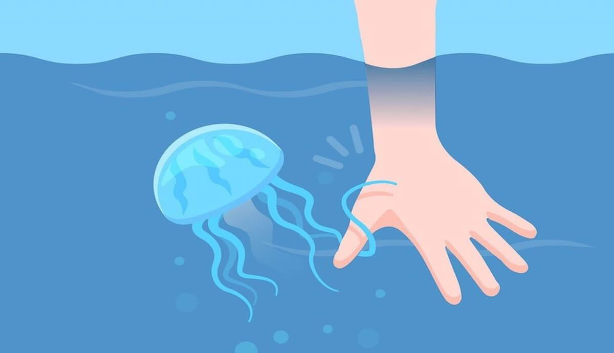 Большая вспышка пурпурных медуз – что делать, если ужалили