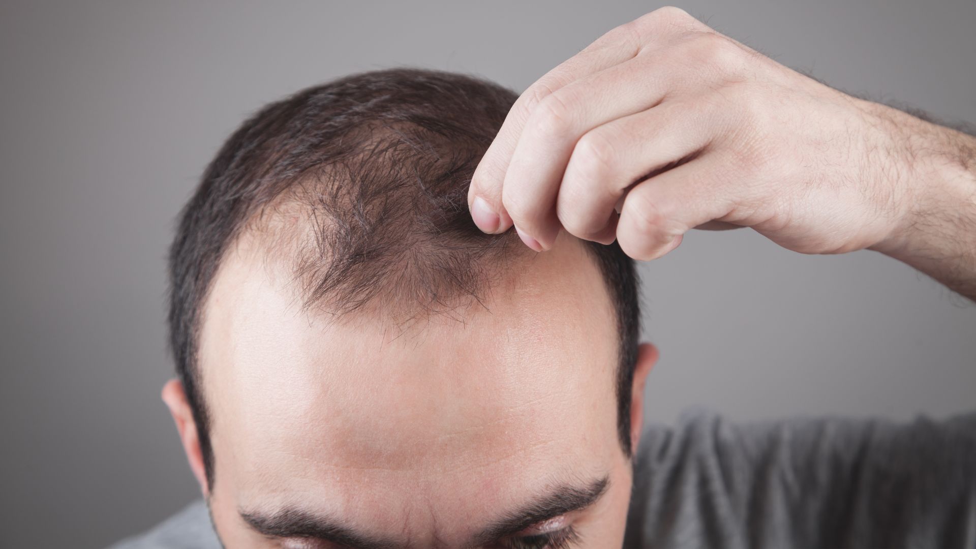 Hair Loss Treatment With Pharmaceutical Treatment